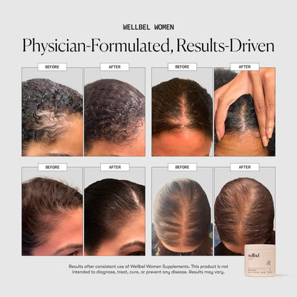 WELLBEL Women Hair, Skin & Nails Supplement (90 Count)